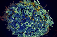 Francouzka se zbavila viru HIV. Je teprve osmá na světě
