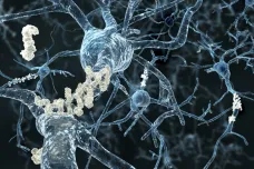 EK poprvé schválila přípravek proti Alzheimerově chorobě