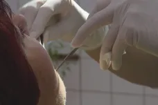 V době dovolených zubařů je těžké ošetřit na západě Čech bolavý zub. Jeden kraj nemá pohotovost vůbec, druhý jedinou
