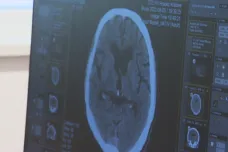 Extrémní únava i neurologické potíže. Dlouhý covid se rozvinul nejméně u osmi procent lidí